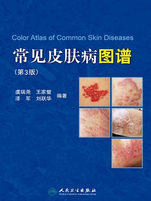 cover image of 常见皮肤病图谱